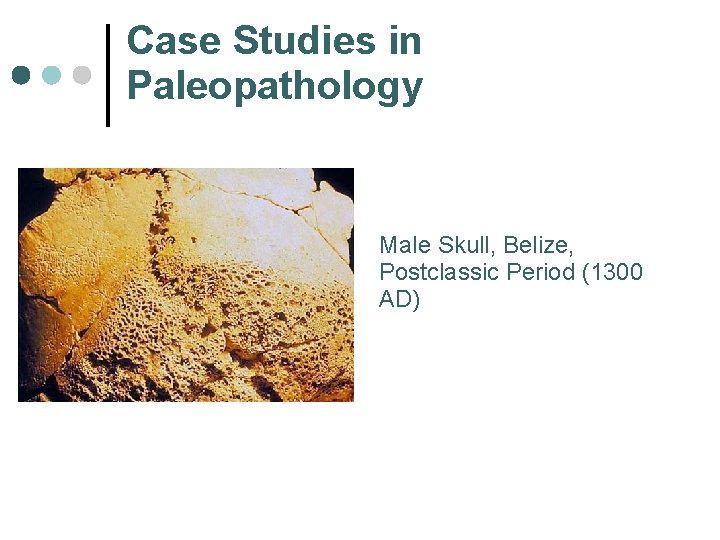 Case Studies in Paleopathology Male Skull, Belize, Postclassic Period (1300 AD) 