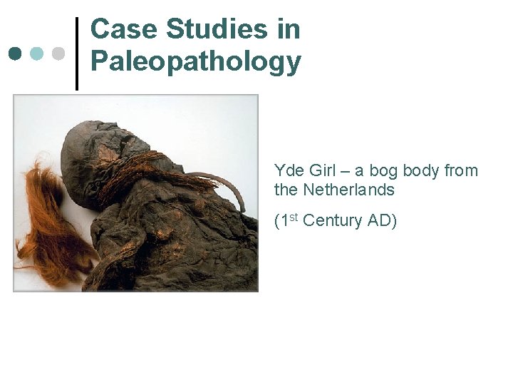 Case Studies in Paleopathology Yde Girl – a bog body from the Netherlands (1