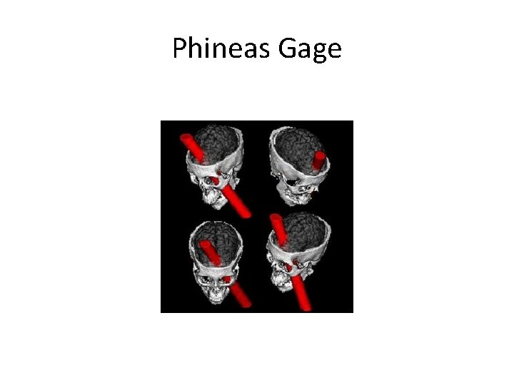 Phineas Gage 