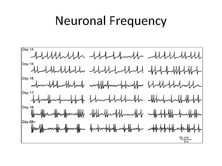 Neuronal Frequency 
