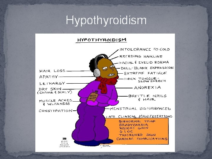 Hypothyroidism 