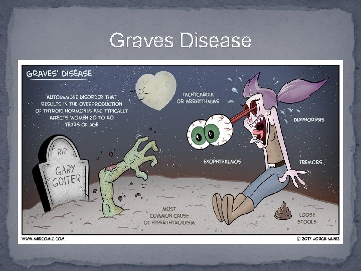 Graves Disease 