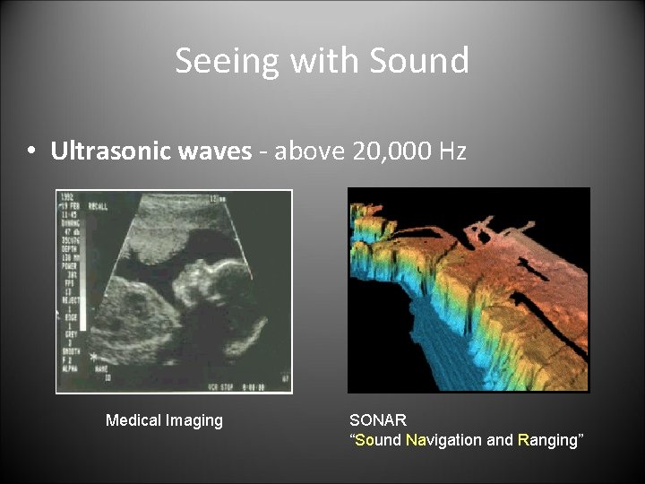 Seeing with Sound • Ultrasonic waves - above 20, 000 Hz Medical Imaging SONAR