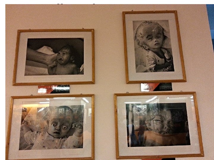 Effects of Agent Orange 