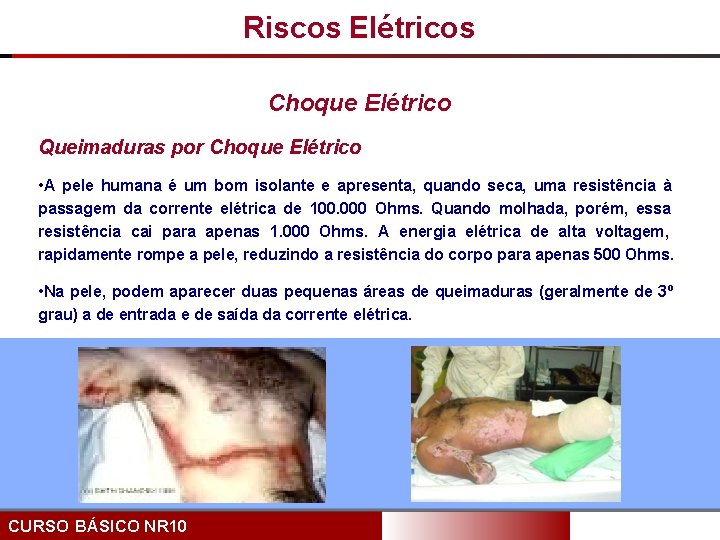 Riscos Elétricos Choque Elétrico Queimaduras por Choque Elétrico • A pele humana é um