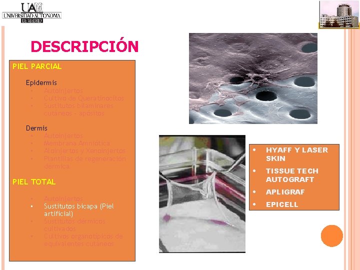 DESCRIPCIÓN PIEL PARCIAL Epidermis • Autoinjertos • Cultivo de Queratinocitos • Sustitutos bilaminares cutáneos