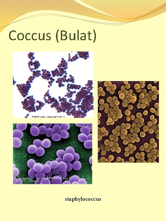 Coccus (Bulat) staphylococcus 