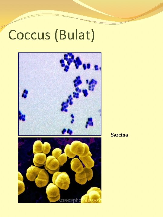 Coccus (Bulat) Sarcina 