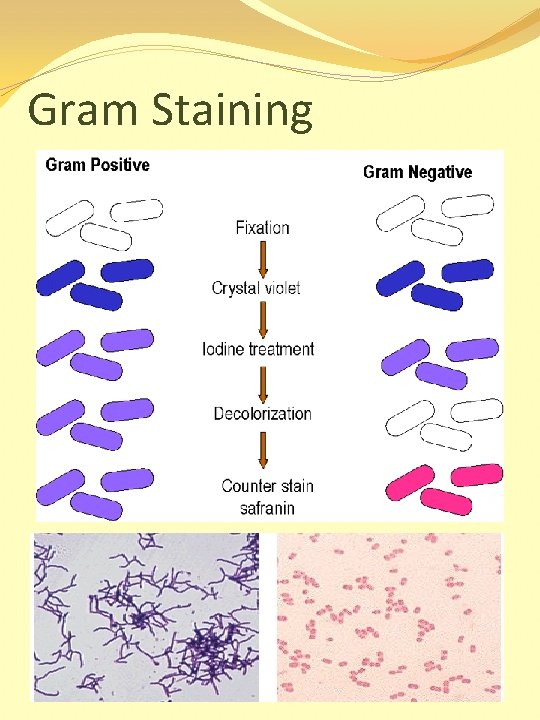 Gram Staining 