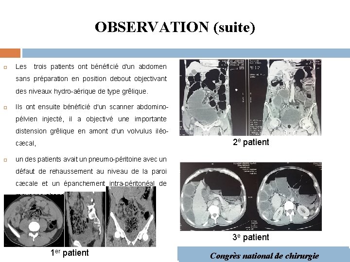 OBSERVATION (suite) Les trois patients ont bénéficié d'un abdomen sans préparation en position debout