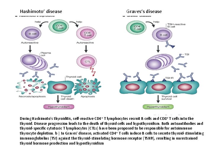 Hashimoto’ disease Graves’s disease During Hashimoto's thyroiditis, self-reactive CD 4+ T lymphocytes recruit B