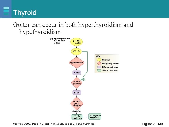 Thyroid Goiter can occur in both hyperthyroidism and hypothyroidism Copyright © 2007 Pearson Education,