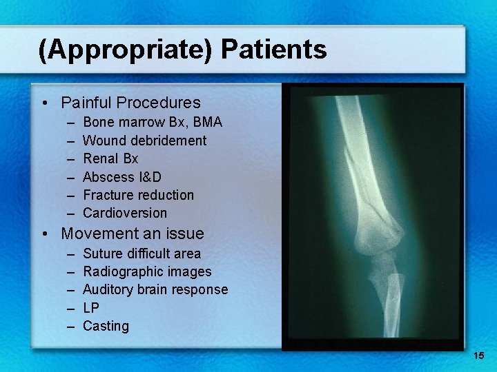 (Appropriate) Patients • Painful Procedures – – – Bone marrow Bx, BMA Wound debridement