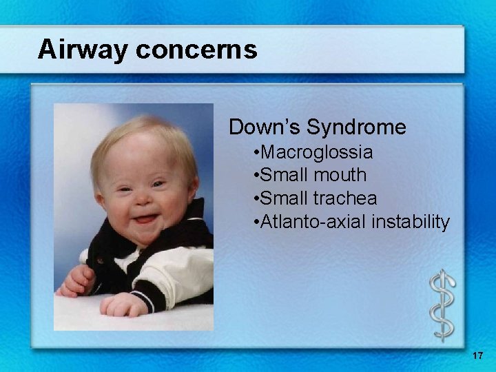 Airway concerns Down’s Syndrome • Macroglossia • Small mouth • Small trachea • Atlanto-axial