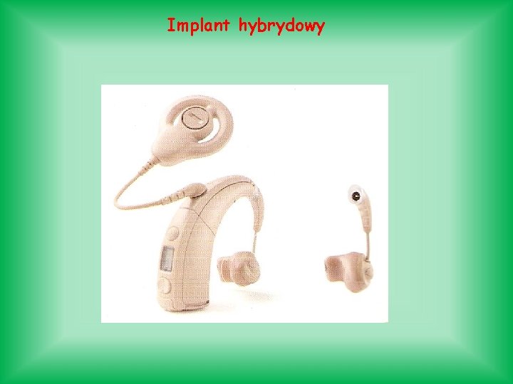 Implant hybrydowy Implant hybrydowy