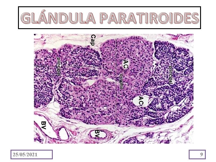 GLÁNDULA PARATIROIDES 25/05/2021 9 
