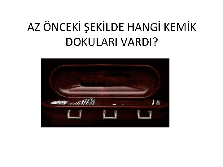 AZ ÖNCEKİ ŞEKİLDE HANGİ KEMİK DOKULARI VARDI? 