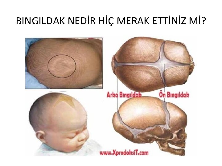 BINGILDAK NEDİR HİÇ MERAK ETTİNİZ Mİ? 