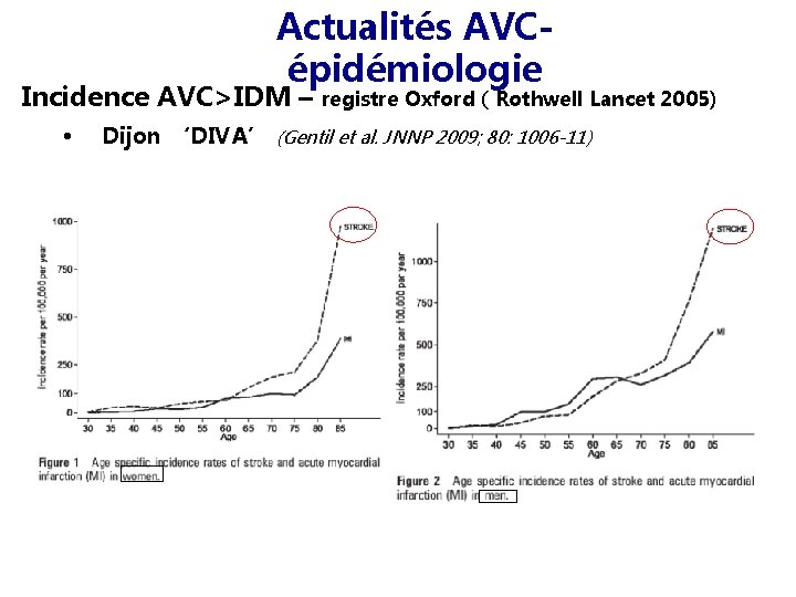 Actualités AVCépidémiologie Incidence AVC>IDM – • registre Oxford ( Rothwell Lancet 2005) Dijon ‘DIVA’