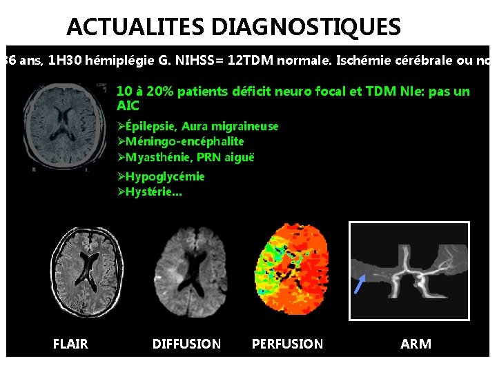 ACTUALITES DIAGNOSTIQUES 36 ans, 1 H 30 hémiplégie G. NIHSS= 12 TDM normale. Ischémie