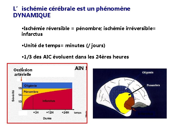 L’ischémie cérébrale est un phénomène DYNAMIQUE • Ischémie réversible = pénombre; ischémie irréversible= infarctus