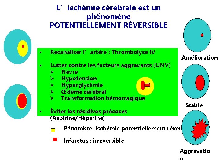 L’ischémie cérébrale est un phénomène POTENTIELLEMENT RÉVERSIBLE • Recanaliser l’artère : Thrombolyse IV •