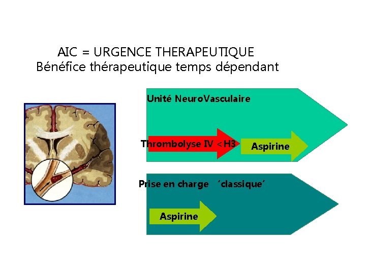 AIC = URGENCE THERAPEUTIQUE Bénéfice thérapeutique temps dépendant Unité Neuro. Vasculaire Thrombolyse IV <H