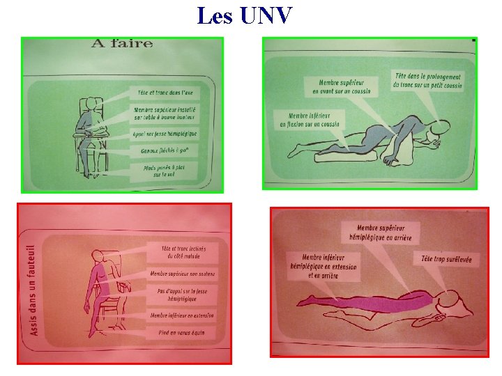Les UNV 