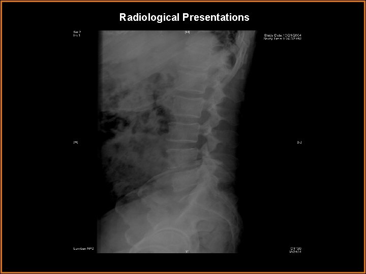 Radiological Presentations 