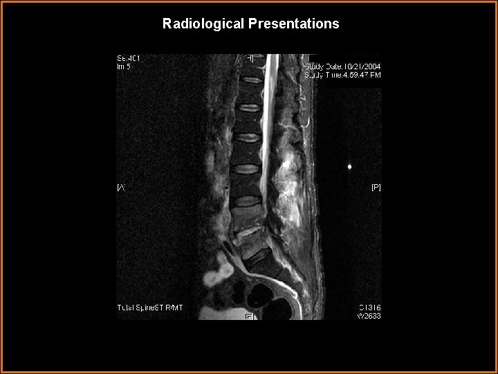 Radiological Presentations 