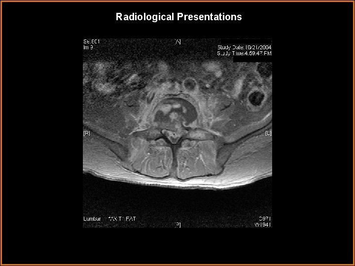 Radiological Presentations 