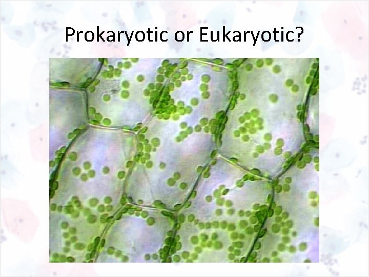 Prokaryotic or Eukaryotic? 