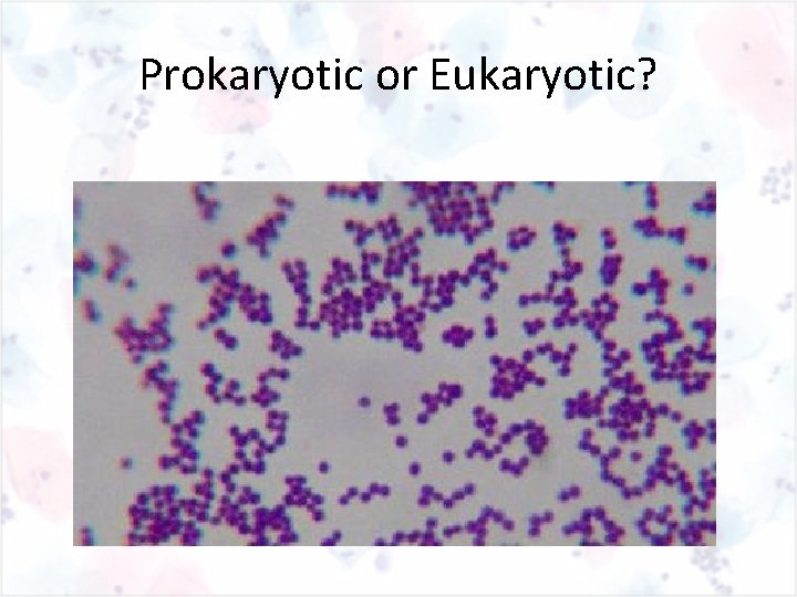 Prokaryotic or Eukaryotic? 