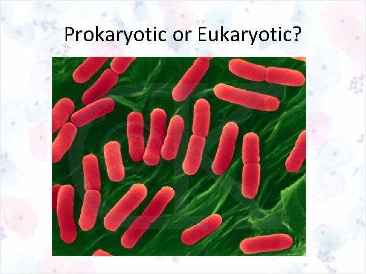 Prokaryotic or Eukaryotic? 