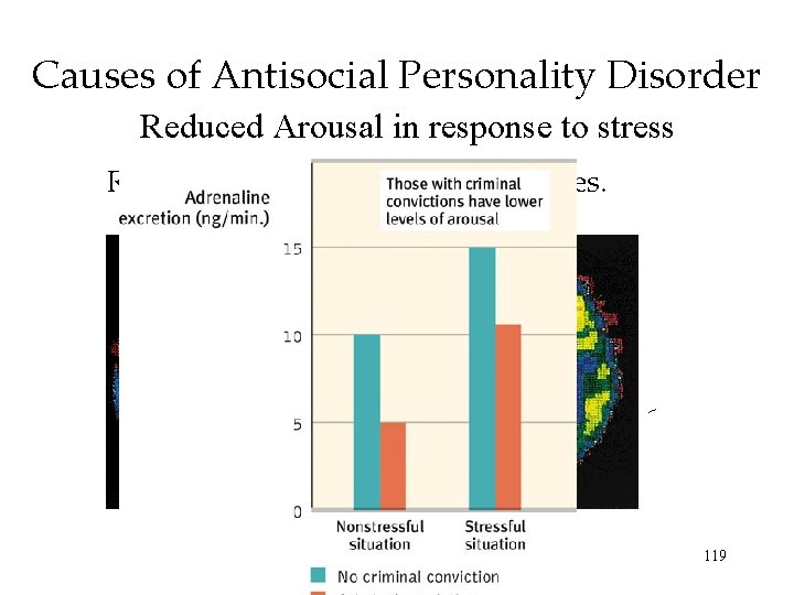 Causes of Antisocial Personality Disorder Reduced Arousal in response to stress Reduced activity in