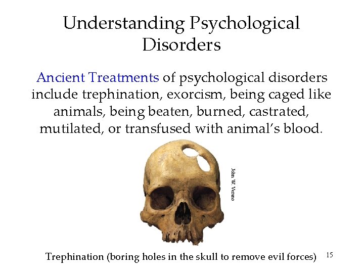 Understanding Psychological Disorders Ancient Treatments of psychological disorders include trephination, exorcism, being caged like