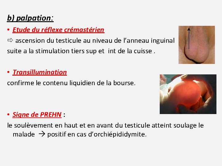 b) palpation: • Etude du réflexe crémastérien ascension du testicule au niveau de l’anneau