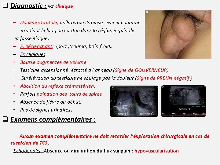 q Diagnostic : est clinique – Douleurs brutale, brutale unilatérale , Intense, vive et