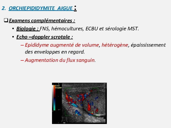 2. ORCHIEPIDIDYMITE AIGUE : q. Examens complémentaires : • Biologie : FNS, hémocultures, ECBU