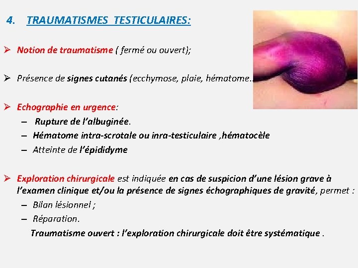 4. TRAUMATISMES TESTICULAIRES: Ø Notion de traumatisme ( fermé ou ouvert); Ø Présence de