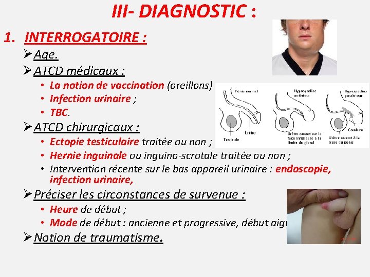 III- DIAGNOSTIC : 1. INTERROGATOIRE : Ø Age. Ø ATCD médicaux : • La