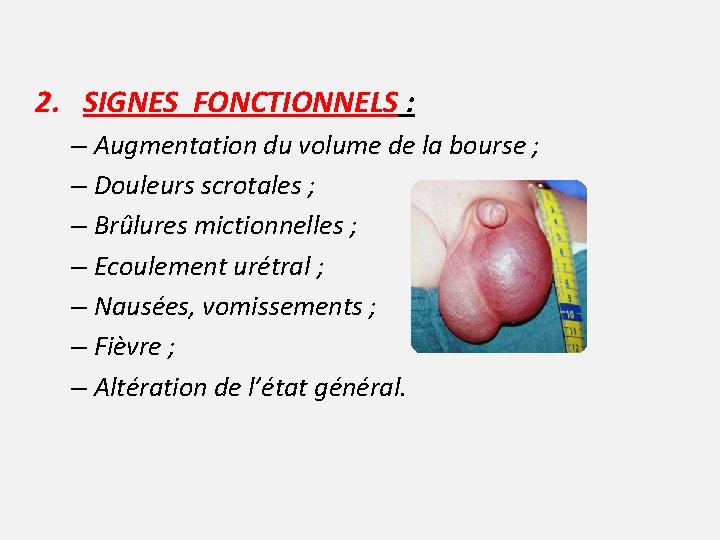 2. SIGNES FONCTIONNELS : – Augmentation du volume de la bourse ; – Douleurs