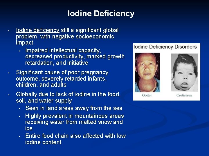 Iodine Deficiency • Iodine deficiency still a significant global problem, with negative socioeconomic impact Iodine Deficiency • Iodine deficiency still a significant global problem, with negative socioeconomic impact