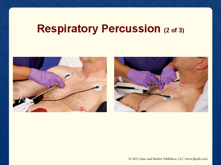 Respiratory Percussion (2 of 3) 