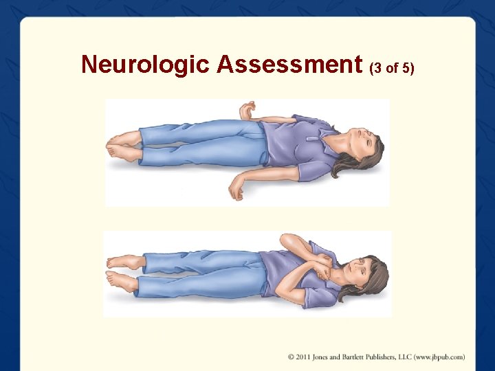 Neurologic Assessment (3 of 5) 