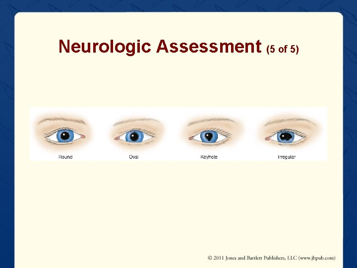 Neurologic Assessment (5 of 5) 