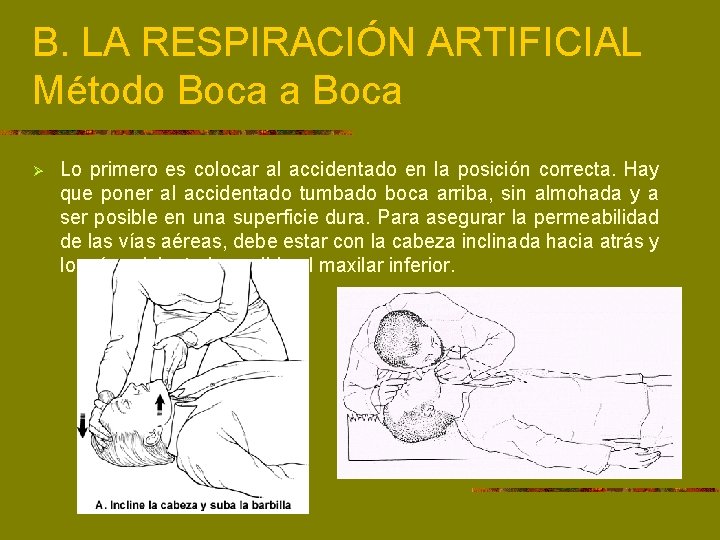 B. LA RESPIRACIÓN ARTIFICIAL Método Boca a Boca Ø Lo primero es colocar al