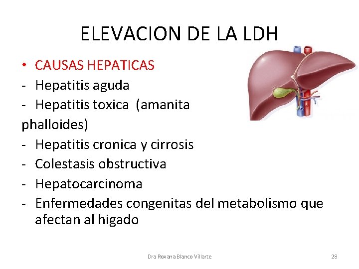 ELEVACION DE LA LDH • CAUSAS HEPATICAS - Hepatitis aguda - Hepatitis toxica (amanita