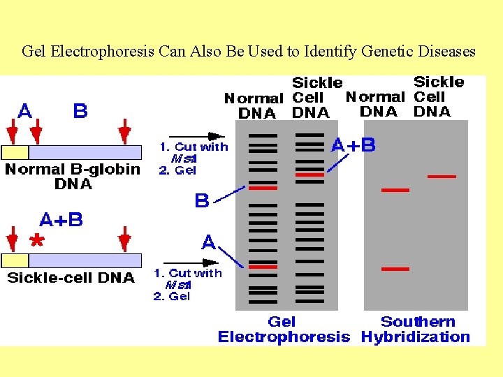 Gel Electrophoresis Can Also Be Used to Identify Genetic Diseases Gel Electrophoresis Can Also Be Used to Identify Genetic Diseases