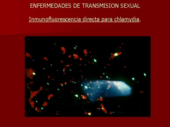 ENFERMEDADES DE TRANSMISION SEXUAL Inmunofluorescencia directa para chlamydia. 